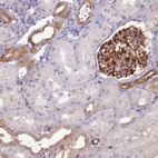 Anti-RGL3 Antibody