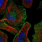 Immunofluorescent staining of human cell line U-2 OS shows localization to plasma membrane.