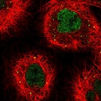 Immunofluorescent staining of human cell line A-431 shows localization to nucleoplasm & vesicles.