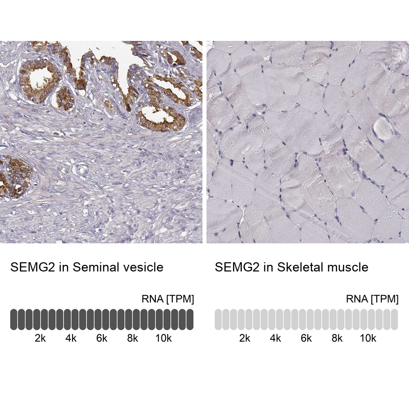 Anti-SEMG2 Antibody