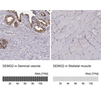 Anti-SEMG2 Antibody