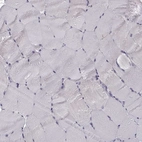 Immunohistochemical staining of human skeletal muscle shows low expression as expected.