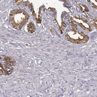 Immunohistochemical staining of human seminal vesicle shows high expression.