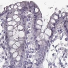 Immunohistochemical staining of human colon using Anti-SEMG2 antibody HPA042767.