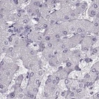 Anti-SEMG2 Antibody