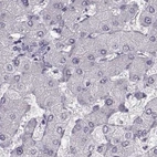Immunohistochemical staining of human liver using Anti-SEMG2 antibody HPA042767.