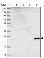 Lane 1: Marker [kDa] 250, 130, 95, 72, 55, 36, 28, 17, 10_br/_Lane 2: Human cell line RT-4_br/_Lane 3: Human cell line U-251MG sp_br/_Lane 4: Human plasma (IgG/HSA depleted)_br/_Lane 5: Human liver tissue
