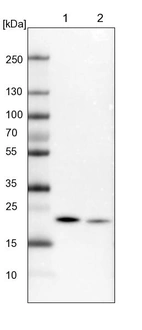 Lane 1: Mouse liver tissue lysate_br/_Lane 2: Rat liver tissue lysate