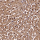 Anti-PSMB3 Antibody