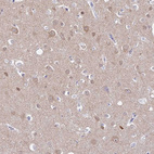 Anti-ADGRA1 Antibody