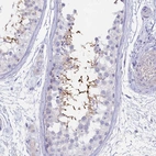 Immunohistochemical staining of human testis shows strong cytoplasmic positivity in spermatids.