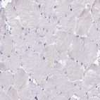 Immunohistochemical staining of human skeletal muscle shows no positivity in myocytes as expected.