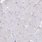 Immunohistochemical staining of human skeletal muscle shows no positivity in myocytes as expected.