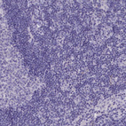 Immunohistochemical staining of human lymph node shows no positivity in non-germinal center cells as expected.