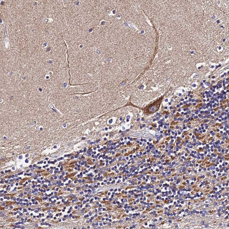 Anti-ZNF573 Antibody
