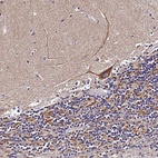 Anti-ZNF573 Antibody