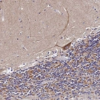 Anti-ZNF573 Antibody