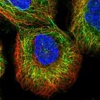 Immunofluorescent staining of human cell line A-431 shows localization to intermediate filaments.