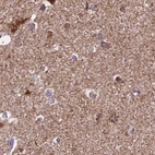 Immunohistochemical staining of human cerebral cortex using Anti-ATP5H antibody HPA042777.