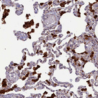 Immunohistochemical staining of human lung shows strong cytoplasmic positivity in macrophages.