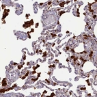 Immunohistochemical staining of human lung shows strong cytoplasmic positivity in macrophages.