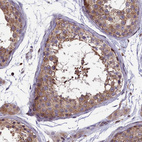 Immunohistochemical staining of human testis shows strong cytoplasmic positivity in cells in seminiferous ducts.