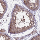 Immunohistochemical staining of human testis shows strong cytoplasmic positivity in cells in seminiferous ducts.