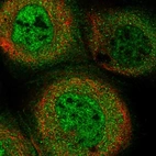 Immunofluorescent staining of human cell line A-431 shows localization to nuclear speckles & cytosol.