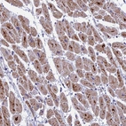 Anti-MT-CO3 Antibody