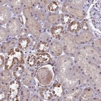 Immunohistochemical staining of human kidney shows moderate to strong granular cytoplasmic positivity in cells in tubules.