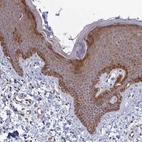 Immunohistochemical staining of human skin shows moderate to strong granular cytoplasmic positivity in squamous epithelial cells.