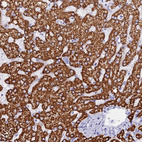 Anti-ISCA1 Antibody
