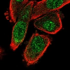 Immunofluorescent staining of human cell line PC-3 shows localization to nucleoplasm.