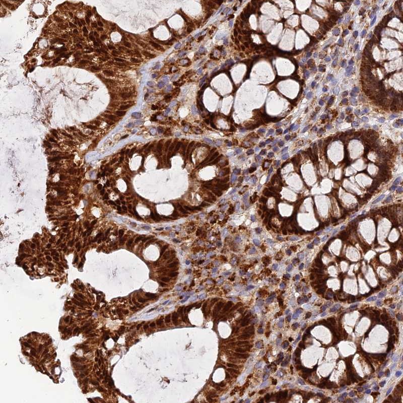 Anti-PODNL1 Antibody