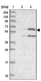 Lane 1: Marker [kDa] 250, 130, 95, 72, 55, 36, 28, 17, 10_br/_Lane 2: Human cell line RT-4_br/_Lane 3: Human cell line U-251MG sp