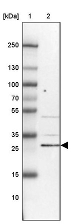 Anti-KIAA1257 Antibody