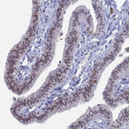 Immunohistochemical staining of human fallopian tube shows moderate nuclear positivity in glandular cells.