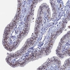 Immunohistochemical staining of human fallopian tube shows moderate nuclear positivity in glandular cells.