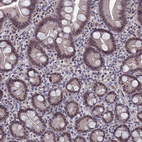 Immunohistochemical staining of human small intestine shows moderate nuclear positivity in glandular cells.