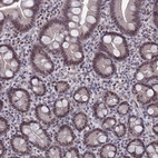 Immunohistochemical staining of human small intestine shows moderate nuclear positivity in glandular cells.