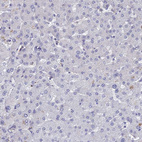 Immunohistochemical staining of human liver shows no positivity in hepatocytes as expected.