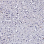 Immunohistochemical staining of human liver shows no positivity in hepatocytes as expected.