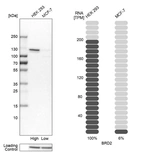 Western blot analysis in human cell lines HEK293 and MCF-7 using Anti-BRD2 antibody. Corresponding BRD2 RNA-seq data are presented for the same cell lines. Loading control: Anti-HSP90B1.