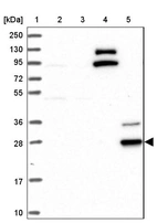Lane 1: Marker [kDa] 250, 130, 95, 72, 55, 36, 28, 17, 10_br/_Lane 2: Human cell line RT-4_br/_Lane 3: Human cell line U-251MG sp_br/_Lane 4: Human plasma (IgG/HSA depleted)_br/_Lane 5: Human liver tissue