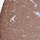 Immunohistochemical staining of human cerebral cortex shows strong positivity in nucleoli in neurons.