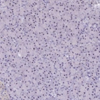 Immunohistochemical staining of human pancreas shows strong positivity in nucleoli in exocrine glandular cells.