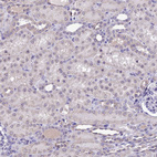 Immunohistochemical staining of human kidney shows moderate positivity in nucleoli in cells in tubules.