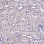 Immunohistochemical staining of human kidney shows moderate positivity in nucleoli in cells in tubules.