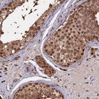 Anti-PSMC6 Antibody