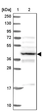 Lane 1: Marker [kDa] 250, 130, 95, 72, 55, 36, 28, 17, 10_br/_Lane 2: Human cell line RT-4